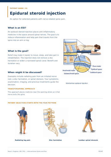 Cover of Epidural steroid injections patient guide