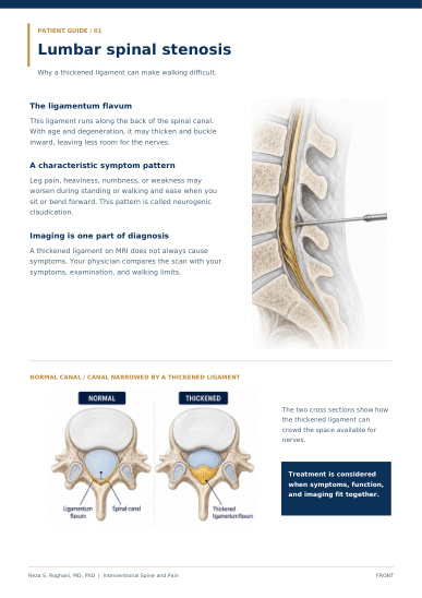 Cover of Lumbar spinal stenosis & MILD patient guide